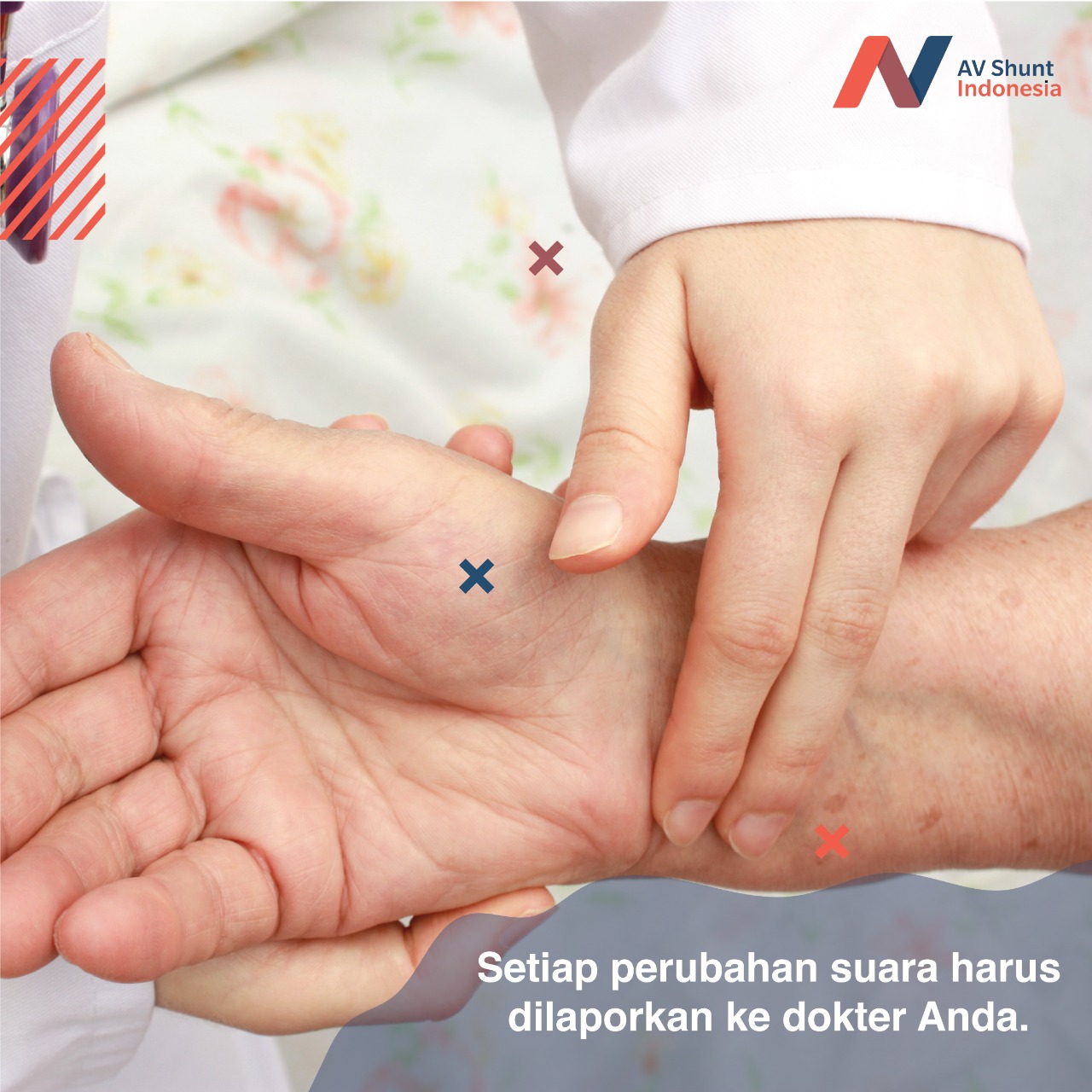 http://avshuntindonesia.com/images/blog/BLOG__av-shunt-untuk-hemodialisis__20200214113542.jpg